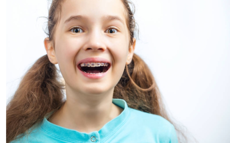 Straighten Out a Child's Teeth with Braces - Stars Fact